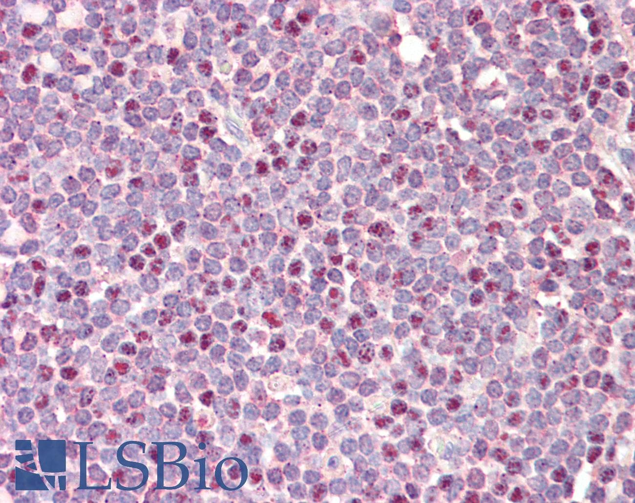 CDCA5 / Sororin Antibody (aa110-159)
