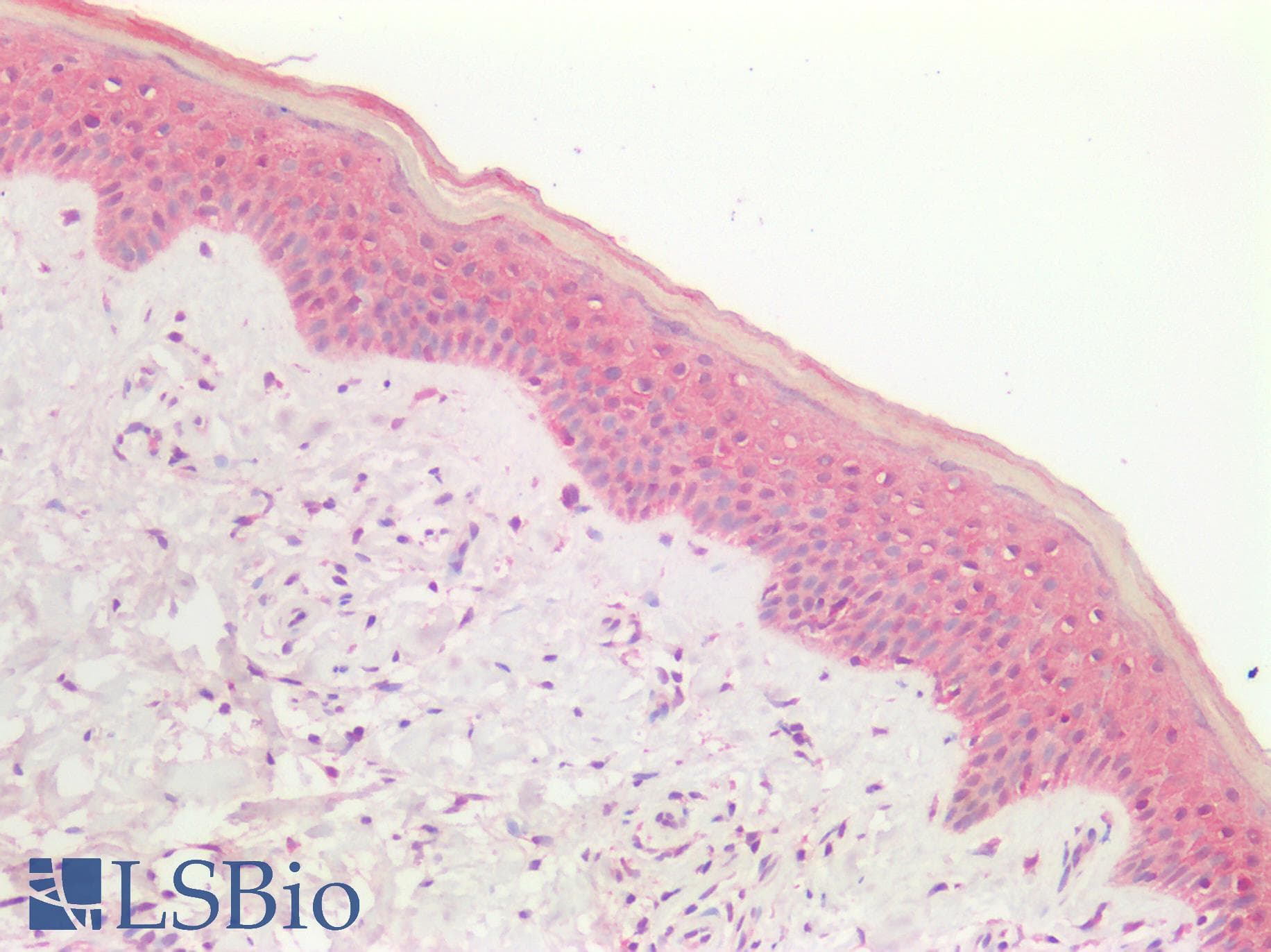 PathPlus™ GRB7 Antibody