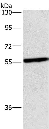 Polyclonal Rabbit anti-Human CEP55 Antibody (WB)