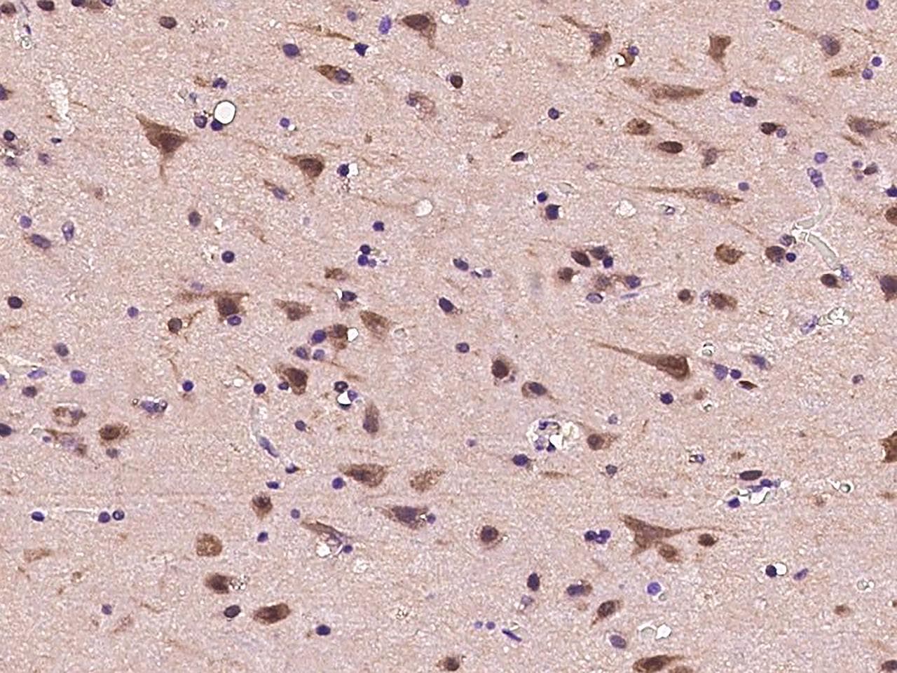 Polyclonal Rabbit anti-Human PSMC2 / RPT1 Antibody (IHC, WB)