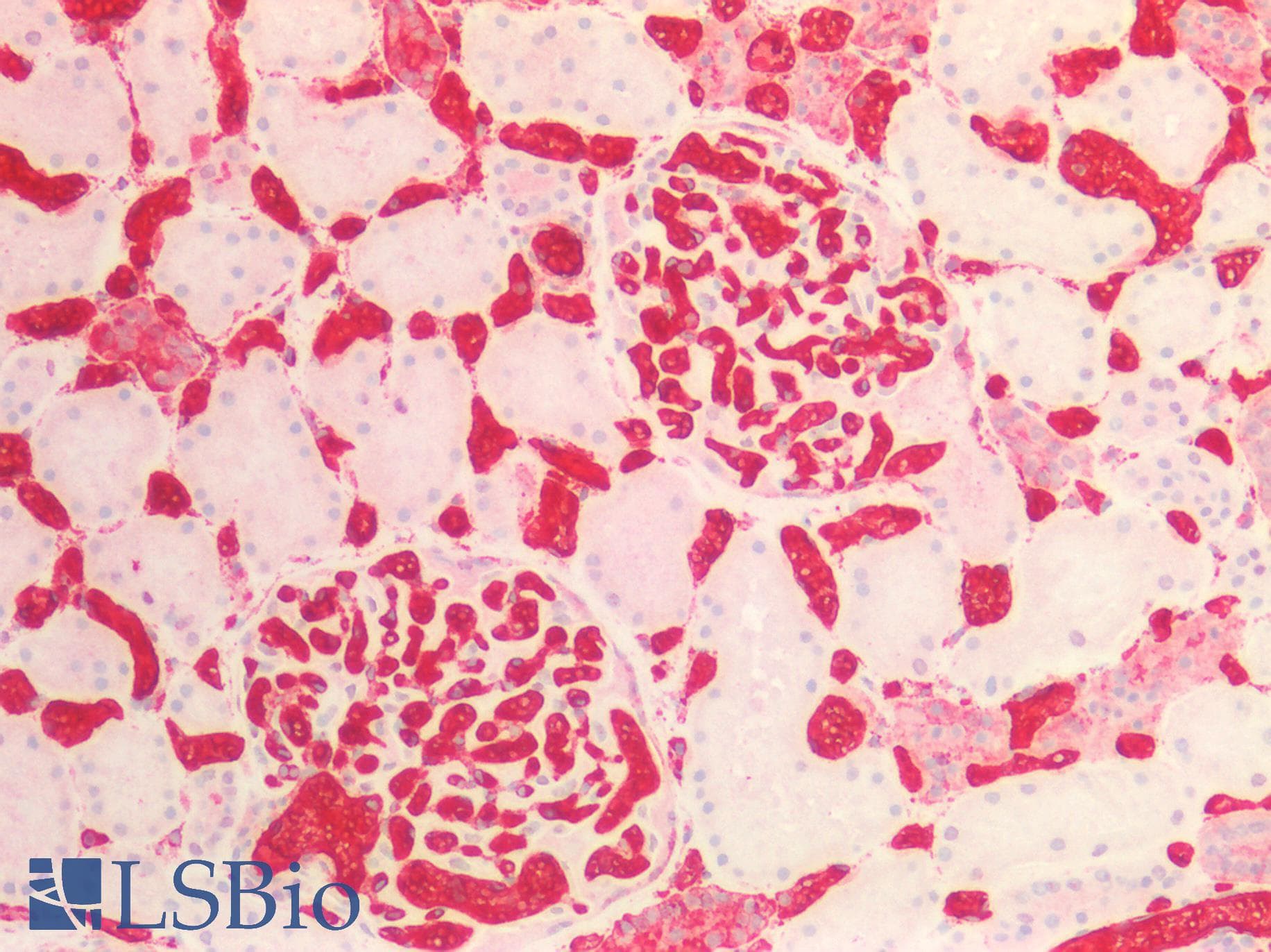 IHC-plus™ Blood Group A Antibody (clone 3-3A)