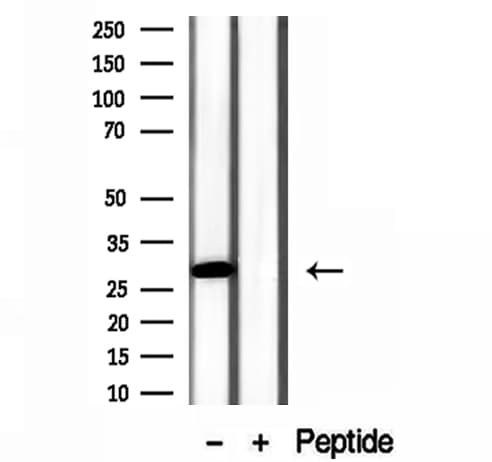 GSTA4 Antibody