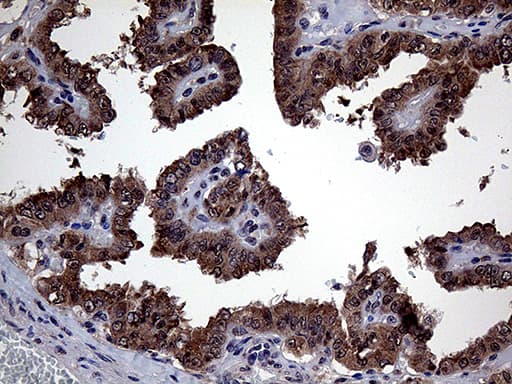 GLS2 / Glutaminase 2 Antibody (clone OTI1C12)
