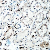 TNC / Tenascin C Antibody (C-Terminus)