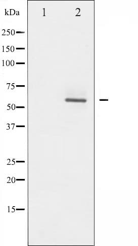 Polyclonal Rabbit anti-Human AKT2 Antibody (phospho-Ser474, IHC, IF, WB)