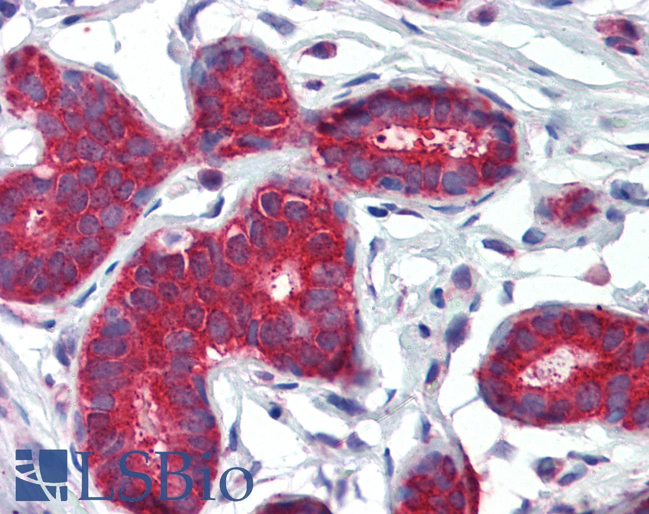IHC-plus™ PTCH1 / Patched 1 Antibody (aa1431-1442)