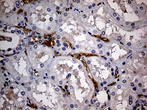 JUP/CTNNG/Junction Plakoglobin Antibody (aa500-745, clone OTI1B4)
