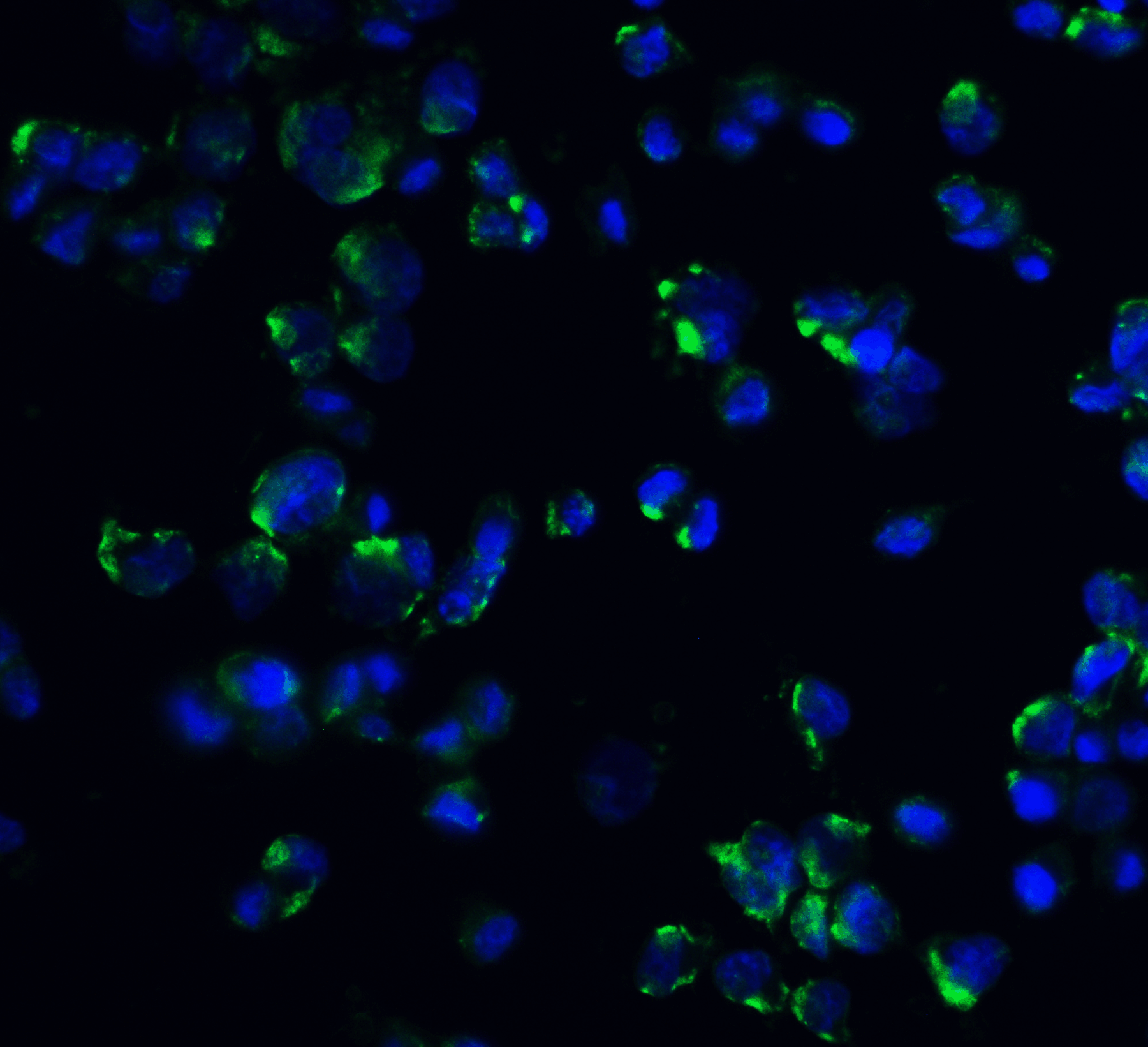IHC-plus™ GOK / STIM1 Antibody
