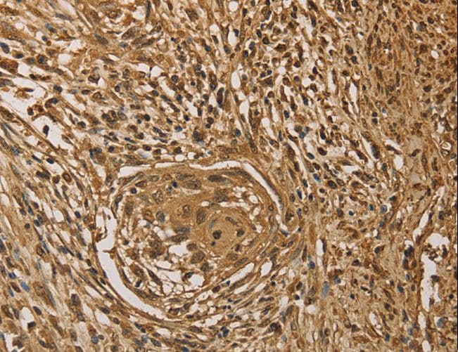 Polyclonal Rabbit anti-Human PRDM14 Antibody (IHC)