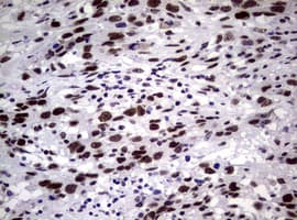NBN / Nibrin Antibody (clone OTI6E11)