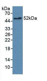 ERBB2 / HER2 Antibody (aa376-578, PE)