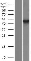 TUBB7P Protein (Over-Expression Lysate Myc-DDK (Flag))