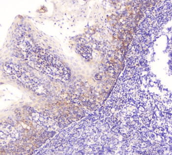 EML4 Antibody