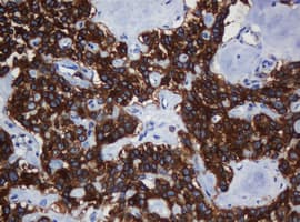 TAPBPL / TAPBPR Antibody (clone OTI5D7, Carrier-free)