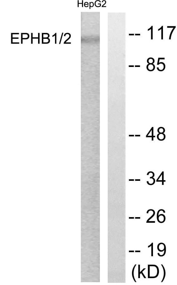 EPH Receptor B1+B2 Antibody (Internal)