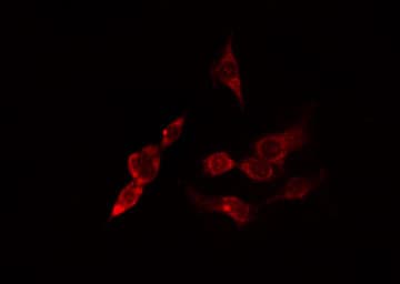 ACTR3 Antibody