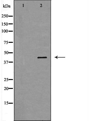 HP / Haptoglobin Antibody