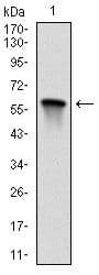 Monoclonal Mouse anti-Human MAP2K7 / MEK7 Antibody (clone 400000, IHC, IF, WB)