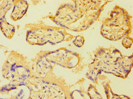 Polyclonal Rabbit anti-Human ETK / BMX Antibody (aa65-280, IHC)