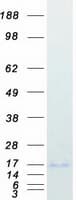 Human HBG1 / Fetal Hemoglobin Protein (Recombinant Myc-DDK (Flag))