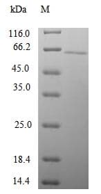 Human SNTG1 Protein (Recombinant 10His, N-terminus + Myc, C-terminus)