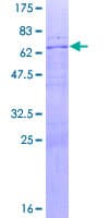 Human TEL-2 / ETV7 Protein (Recombinant GST)