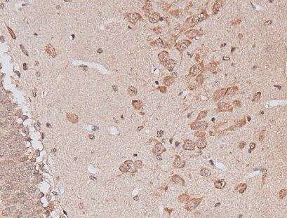 Neuropeptide Y / NPY Antibody