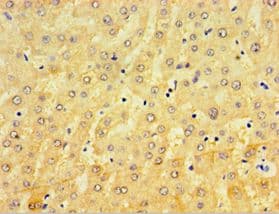 Polyclonal Rabbit anti-Human CRD / CRX Antibody (aa120-285, IHC, WB)