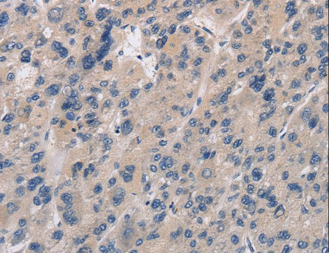 Polyclonal Rabbit anti-Human IMPDH1 Antibody (IHC, WB)
