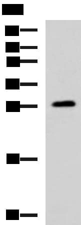 Polyclonal Rabbit anti-Human PAFAH1B3 Antibody (IHC, WB)