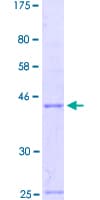 Human EN2 Protein (Recombinant GST, N-terminus)