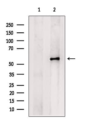 Polyclonal Rabbit anti-Human PCSK9 Antibody (IF, WB)