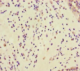 GAR1 / NOLA1 Antibody