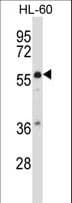 Mucolipin 3 / TRPML3 Antibody (aa517-546)