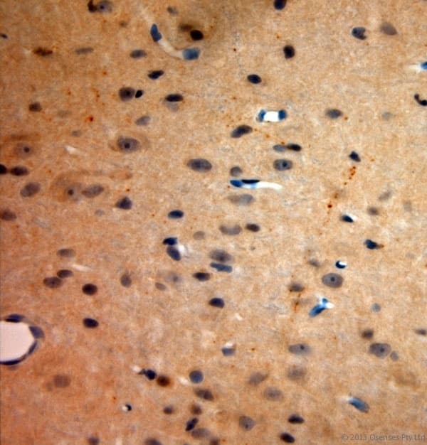 TACR1 / NK1R Antibody (aa150-200)
