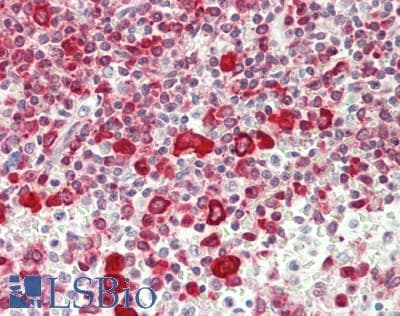 IHC-plus™ YBX1 / YB1 Antibody (aa274-324)