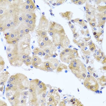 Polyclonal Rabbit anti-Human CETN3 Antibody (IHC, WB)
