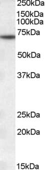 IHC-plus™ Polyclonal Goat anti-Human MTM1 / Myotubularin Antibody (aa590-603, IHC, WB)