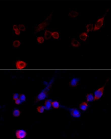 FLNA / Filamin A Antibody