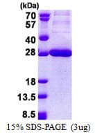 Human CEACAM21 Protein (Recombinant His)