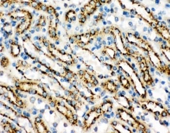 CTSD / Cathepsin D Antibody (aa65-410)