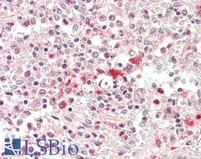 IHC-plus™ ABCB7 Antibody (C-Terminus)
