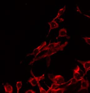 PRLHR / GPR10 Antibody