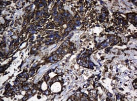 HSPD1 / HSP60 Antibody (clone OTI3G1)