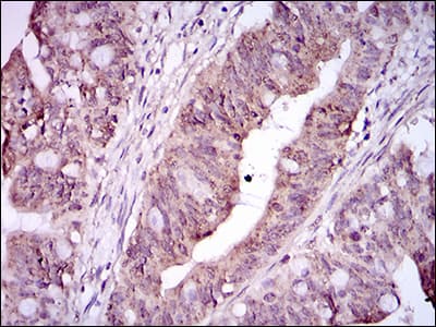ITGA2B / CD41 Antibody (aa45-149, clone 2E10C9)