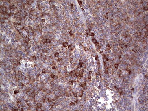 LGALS3 / Galectin 3 Antibody (clone OTI2F1)
