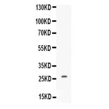CNTF Antibody (aa12-200)