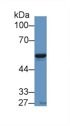 NAMPT / Visfatin Antibody (aa1-491, APC)
