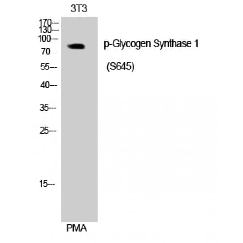 GYS1 / Glycogen Synthase Antibody (580-660 aa)