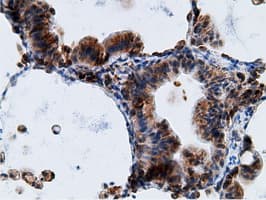 KHK / Ketohexokinase Antibody (clone OTI3D1)